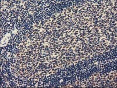 Immunohistochemistry: ZIM2 Antibody (OTI7G1) - Azide and BSA Free [NBP2-74929]