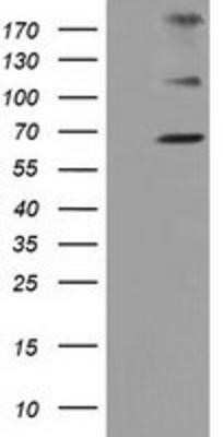 Western Blot: ZIM2 Antibody (OTI7G1)Azide and BSA Free [NBP2-74929]