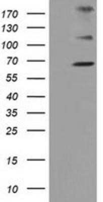 Western Blot: ZIM2 Antibody (OTI7G1) [NBP2-03325]