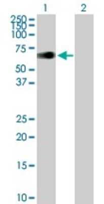 Western Blot: ZIM2 Antibody [H00023619-B01P]