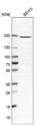 Western Blot: 0 [NBP1-80590]