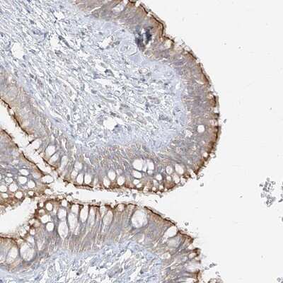 Immunohistochemistry-Paraffin: ZIM3 Antibody [NBP1-80589]