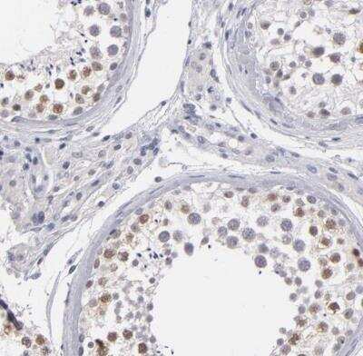 Immunohistochemistry-Paraffin: ZIP4H/Tex11 Antibody [NBP1-80692]