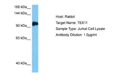 Western Blot: ZIP4H/Tex11 Antibody [NBP2-88636]