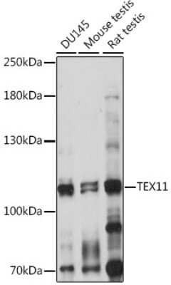 Western Blot: ZIP4H/Tex11 AntibodyAzide and BSA Free [NBP2-94329]