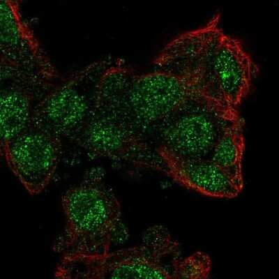 Immunocytochemistry/ Immunofluorescence: ZKSCAN2 Antibody [NBP2-13549]