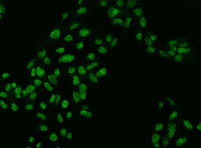 Immunocytochemistry/ Immunofluorescence: ZKSCAN2 Antibody [NBP3-05894]