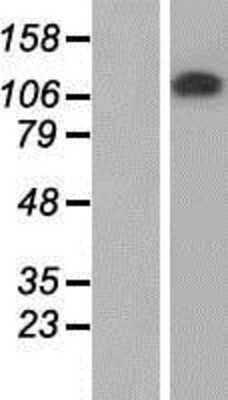 Western Blot: ZKSCAN2 Overexpression Lysate [NBP2-08713]