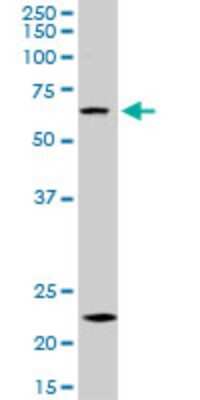 Western Blot: ZKSCAN3 Antibody (2A5) [H00080317-M16]