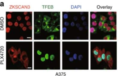 Immunocytochemistry/ Immunofluorescence: ZKSCAN3 Antibody - BSA Free [NBP1-31566]