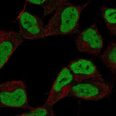 Immunocytochemistry/ Immunofluorescence: ZKSCAN3 Antibody [NBP2-68756]