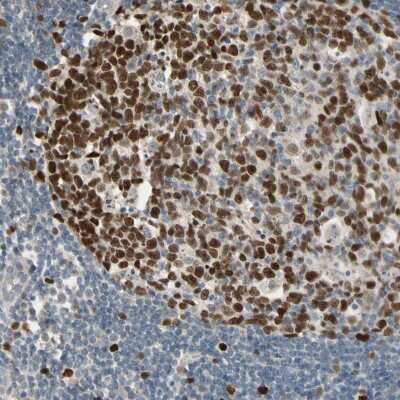 Immunohistochemistry: ZKSCAN3 Antibody [NBP2-47570]
