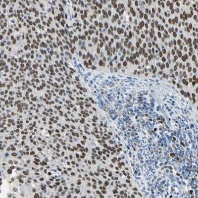 Immunohistochemistry-Paraffin: ZKSCAN3 Antibody [NBP2-47570]