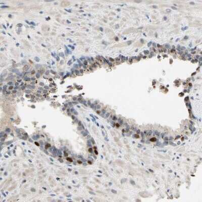 Immunohistochemistry-Paraffin: ZKSCAN3 Antibody [NBP2-47570]