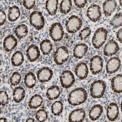 Immunohistochemistry-Paraffin: ZKSCAN3 Antibody [NBP2-47570]