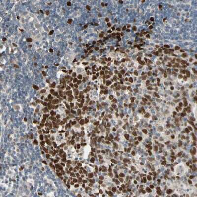 Immunohistochemistry-Paraffin: ZKSCAN3 Antibody [NBP2-47570]
