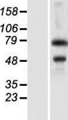 Western Blot: ZKSCAN3 Overexpression Lysate [NBP2-06334]