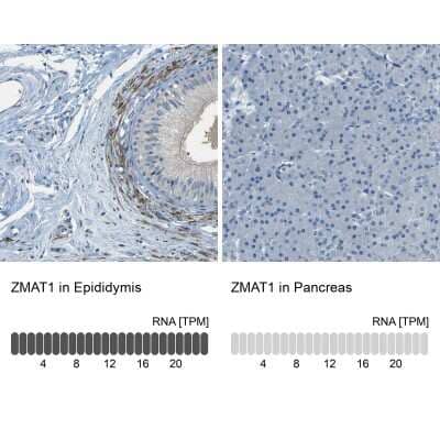 Immunohistochemistry-Paraffin: ZMAT1 Antibody [NBP1-81375]