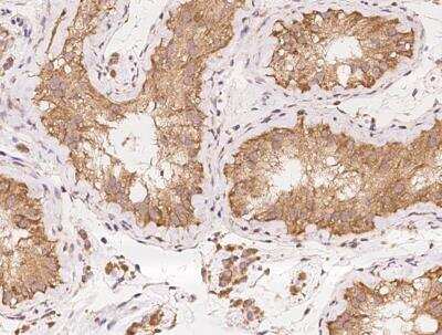 Immunohistochemistry-Paraffin: ZMAT1 Antibody [NBP3-12677]