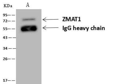 Immunoprecipitation: ZMAT1 Antibody [NBP3-12677]
