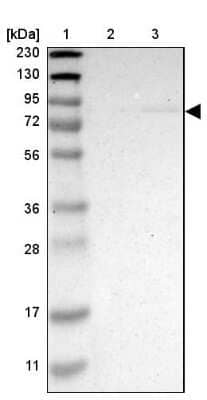 Western Blot: ZMAT1 Antibody [NBP1-81375]