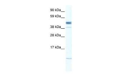 Western Blot: ZMAT1 Antibody [NBP2-83815]