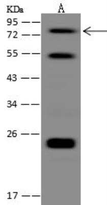 Western Blot: ZMAT1 Antibody [NBP3-12677]