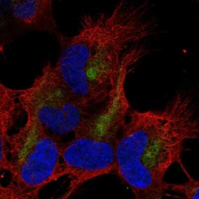 Immunocytochemistry/ Immunofluorescence: ZMAT4 Antibody [NBP2-68726]