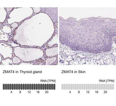 Immunohistochemistry-Paraffin: ZMAT4 Antibody [NBP2-49619]