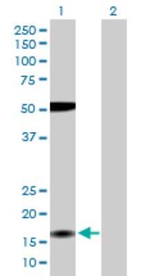 Western Blot: ZMAT4 Antibody [H00079698-D01P]