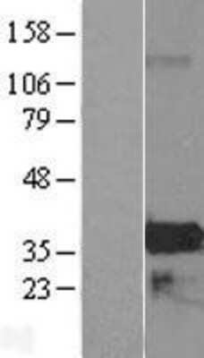 Western Blot: ZMAT4 Overexpression Lysate [NBL1-18042]