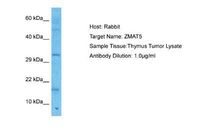 Western Blot: ZMAT5 Antibody [NBP2-83820]