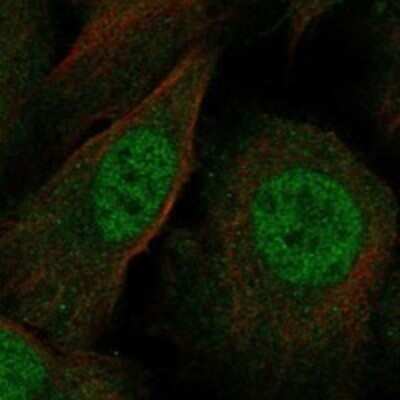 Immunocytochemistry/ Immunofluorescence: ZMIZ1/Zimp10 Antibody [NBP3-17966]