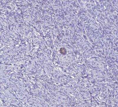 Immunohistochemistry-Paraffin: ZMIZ1/Zimp10 Antibody [NBP1-92610]