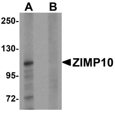 Western Blot: ZMIZ1/Zimp10 AntibodyBSA Free [NBP1-76553]