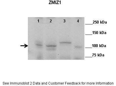 Western Blot: ZMIZ1/Zimp10 Antibody [NBP2-88637]
