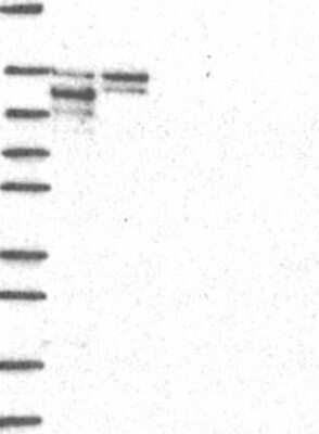 Western Blot: ZMIZ1/Zimp10 Antibody [NBP3-17966]