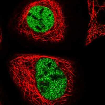 Immunocytochemistry/ Immunofluorescence: ZMIZ2 Antibody [NBP1-85032]