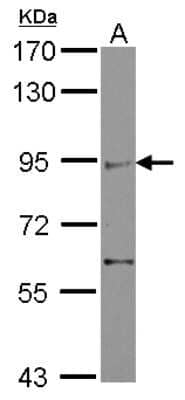 Western Blot: ZMIZ2 Antibody [NBP2-20959]