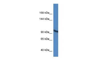 Western Blot: ZMIZ2 Antibody [NBP2-88639]