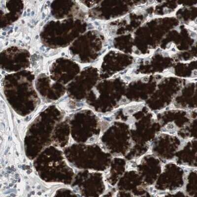 Immunohistochemistry-Paraffin: ZMPSTE24 Antibody [NBP1-84755]