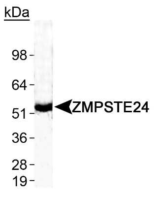 Western Blot: ZMPSTE24 Antibody [NB100-2388]