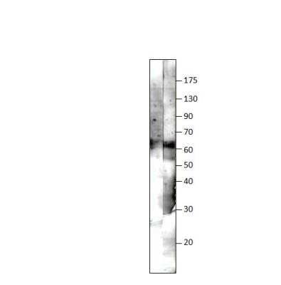 Western Blot: ZMPSTE24 Antibody [NBP3-12432]