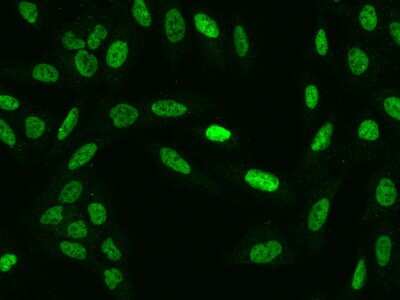 Immunocytochemistry/ Immunofluorescence: ZMYM3 Antibody [NBP2-98112]