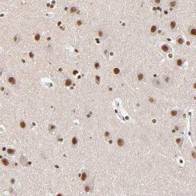 Immunohistochemistry-Paraffin: ZMYM3 Antibody [NBP1-84952]