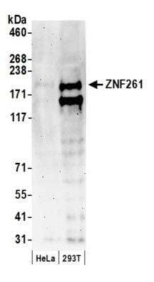 Western Blot: ZMYM3 Antibody [NB100-458]