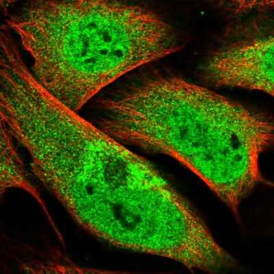 Immunocytochemistry/ Immunofluorescence: ZMYM4 Antibody [NBP2-13550]