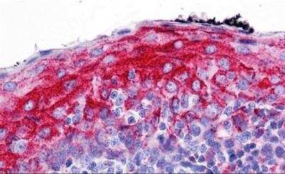 Immunohistochemistry: ZMYM4 Antibody - BSA Free [NBP2-82054]