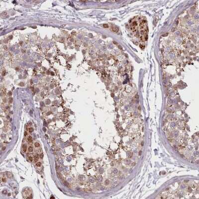 Immunohistochemistry-Paraffin: ZMYM4 Antibody [NBP2-13550]