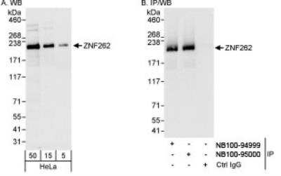 Western Blot: ZMYM4 Antibody [NB100-94999]